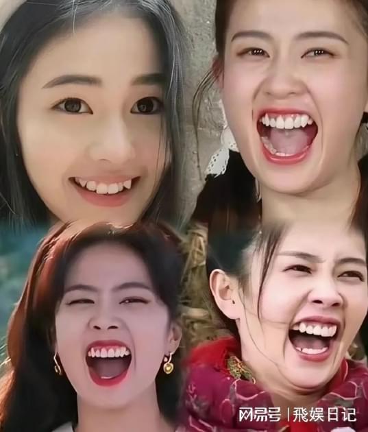 女明星假牙,美丽背后的秘密武器